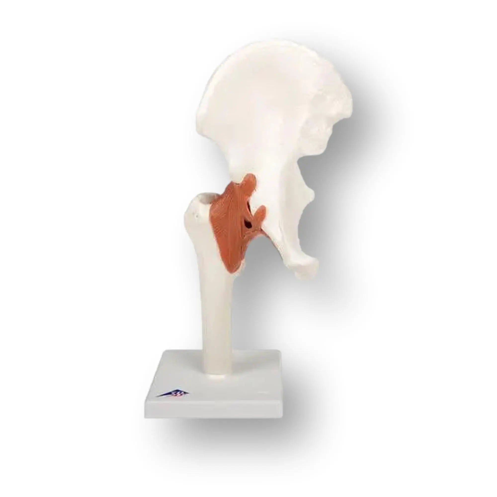 Hip joint - Functional model - Anatomy and pathology